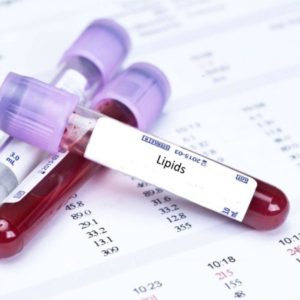 lipids-private-blood-tests-in-london